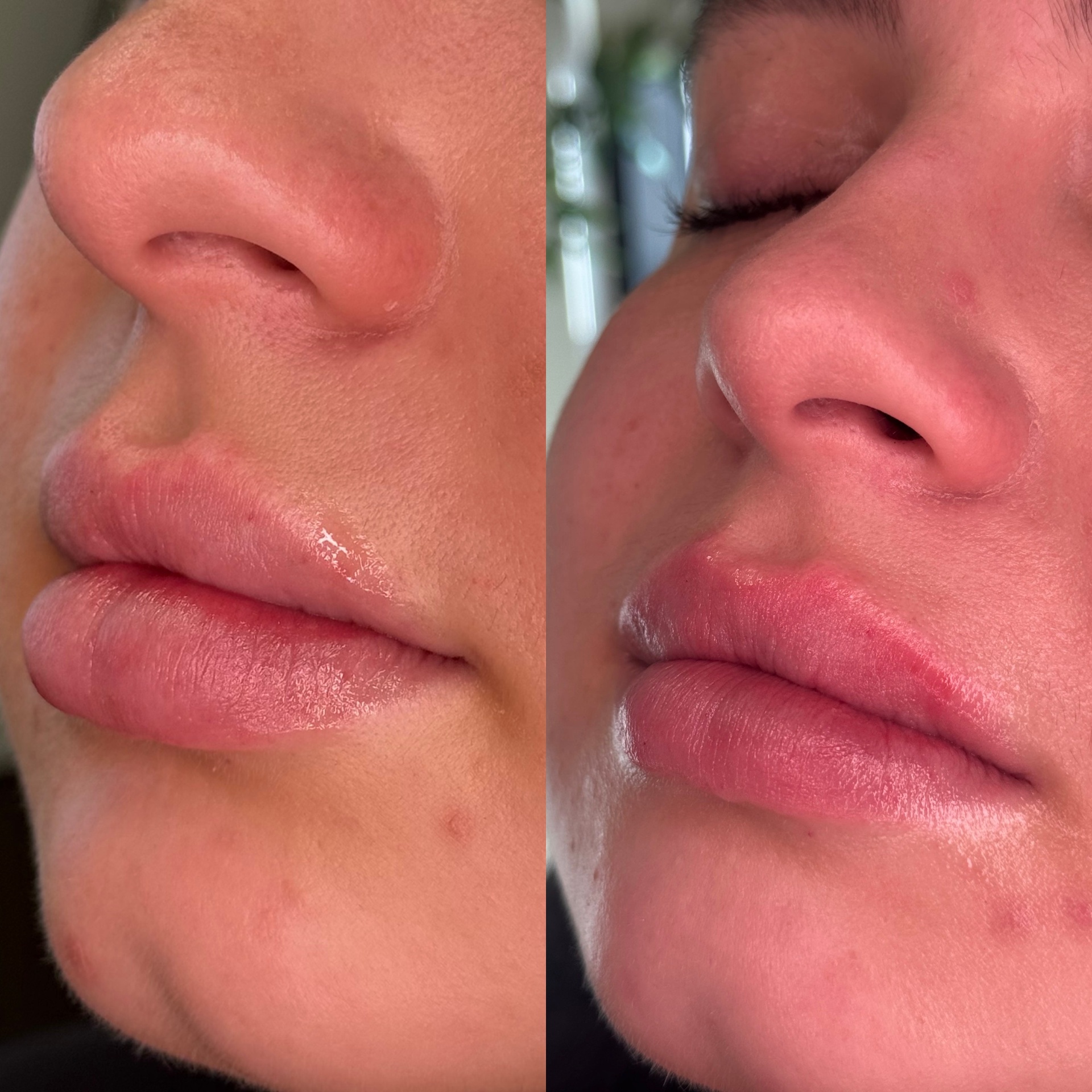 Lip Enhancement result 4