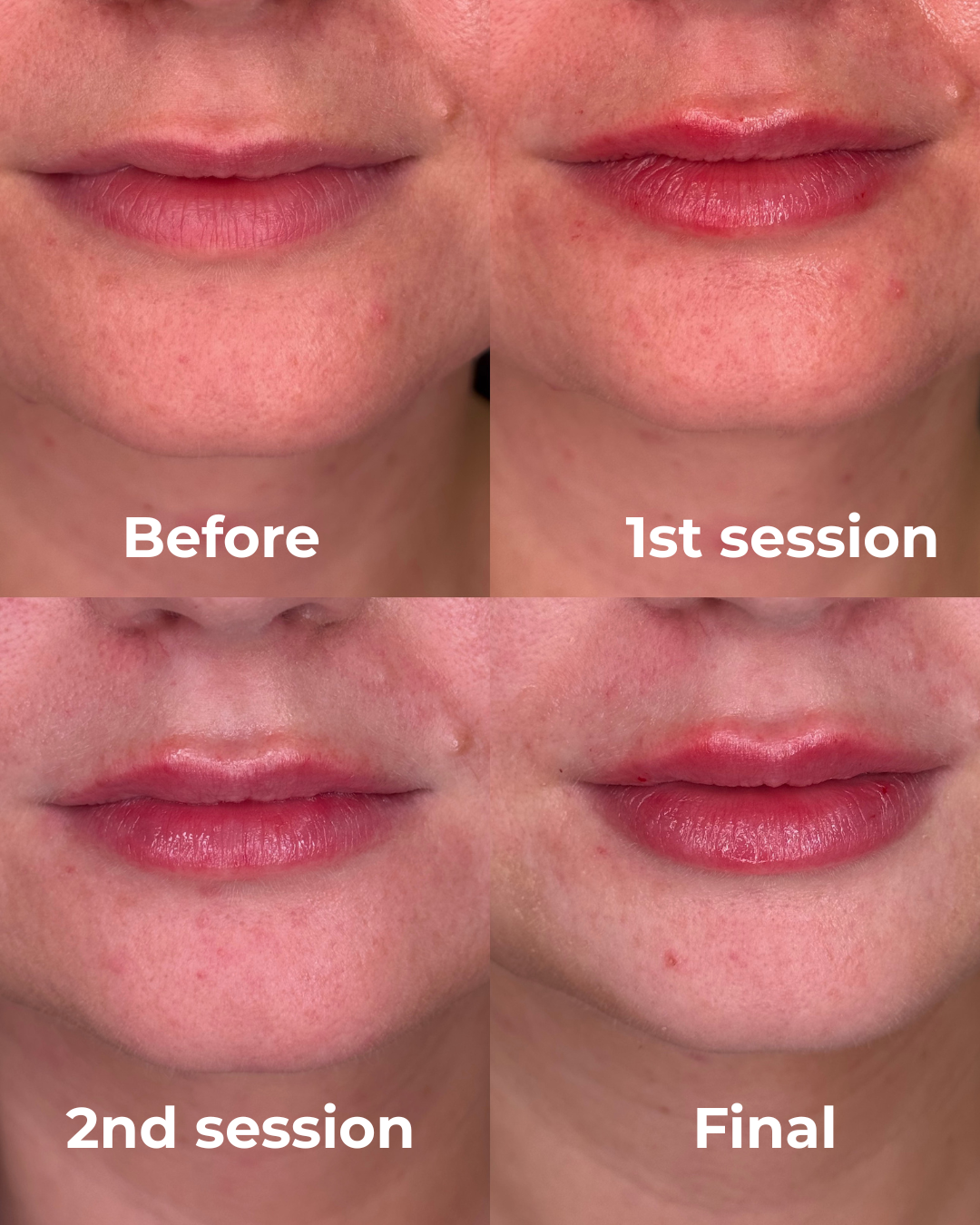 Lip Enhancement result 1
